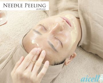 フェイシャルニードルピーリング